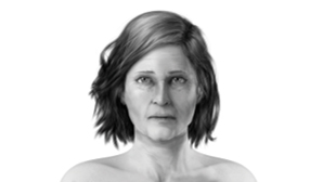 50+-art-filler-anti-aging-fillmed